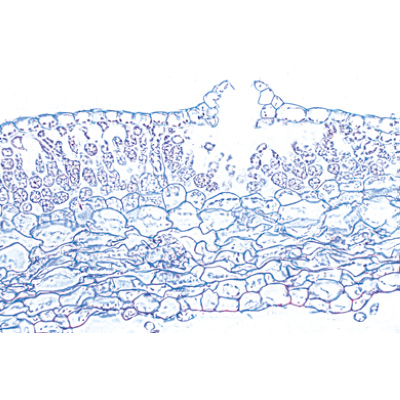 Bryophyta (Liverworts and Mosses) - German Slides, 1003896 [W13014], Microscope Slides LIEDER