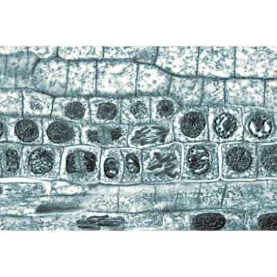 Angiospermes, cellules et tissus - Allemand, 1003908 [W13017], Lames microscopiques Allemand