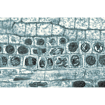 Angiospermes, cellules et tissus - Fran&ccedil;ais, 1003909 [W13017F], Lames microscopiques Fran&ccedil;ais