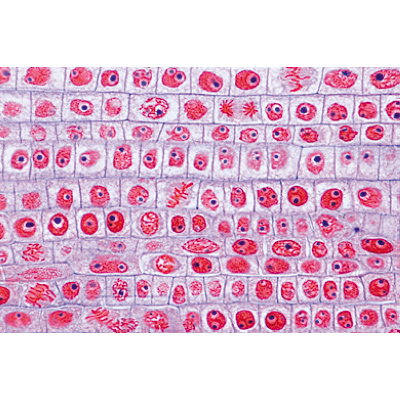 Angiospermae III. Roots - German Slides, 1003912 [W13018], 현미경 슬라이드 LIEDER