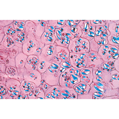 Angiospermae IV. Stems - German Slides, 1003916 [W13019], 현미경 슬라이드 LIEDER
