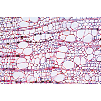 Angiospermae IV. Stems - German Slides, 1003916 [W13019], 현미경 슬라이드 LIEDER