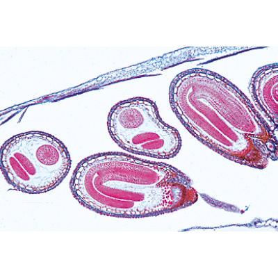 Angiospermae VII. Fruits and Seeds - German Slides, 1003928 [W13022], 显微镜载玻片
