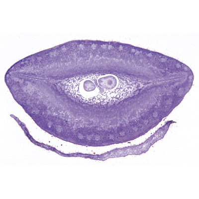 Angiospermes, fruits et graines - Fran&ccedil;ais, 1003929 [W13022F], Lames microscopiques Fran&ccedil;ais