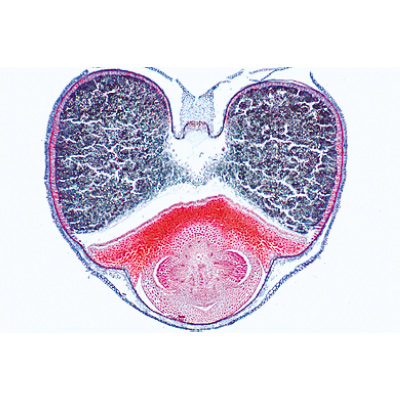 Angiospermae VII. Fruits and Seeds - Spanish, 1003931 [W13022S], 스페인어