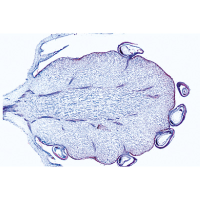 Angiospermae VII. Fruits and Seeds - Spanish, 1003931 [W13022S], 스페인어