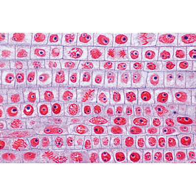 Plant Cell - German Slides, 1003936 [W13024], 현미경 슬라이드 LIEDER