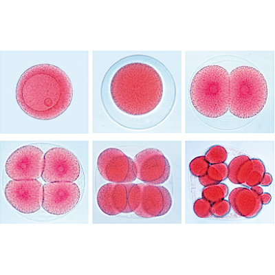 S&eacute;rie de lames g&eacute;n&eacute;tiques - Portugais, 1003942 [W13025P], Lames microscopiques Portugais