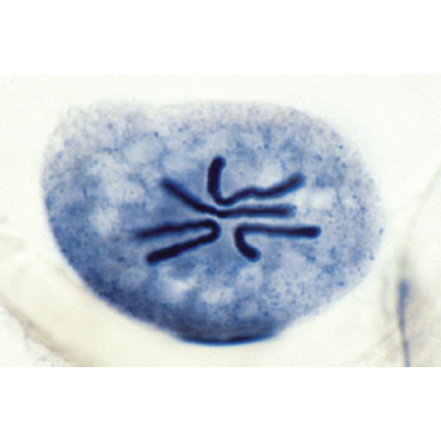 Set of Genetic Slides - Spanish, 1003943 [W13025S], Microscope Slides LIEDER