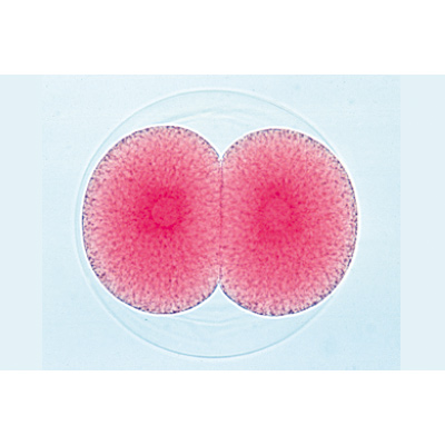 Embryologie de l’oursin de mer (Psammechinus miliaris) - Allemand, 1003944 [W13026], Préparations microscopiques LIEDER