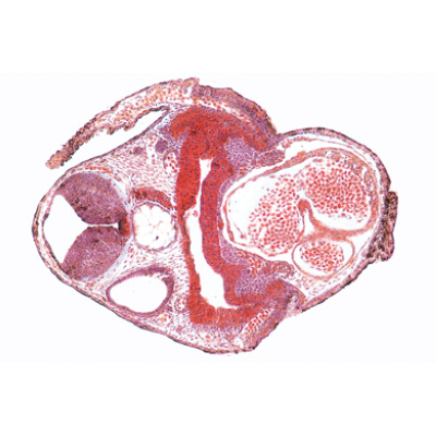 Frog Embryology (Rana) - Spanish, 1003951 [W13027S], 현미경 슬라이드 LIEDER
