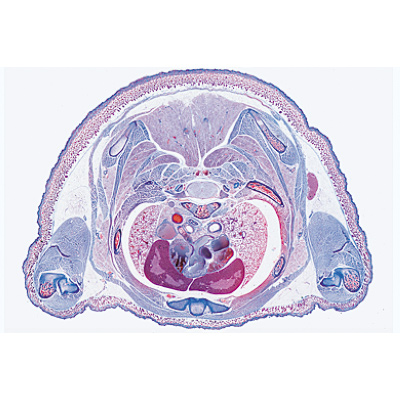 Pig Embryology (Sus scrofa) - French, 1003957 [W13029F], 현미경 슬라이드 LIEDER