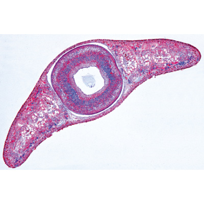 Vermes (Helminthes) - Anglais, 1003962 [W13032], Lames microscopiques Anglais
