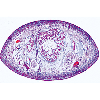 蠕虫类（蠕虫）, 1003962 [W13032], 显微镜载玻片