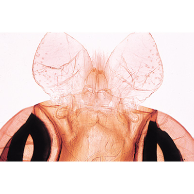 Insectes, s&eacute;rie &eacute;l&eacute;mentaire grossie - Anglais, 1003965 [W13035], Lames microscopiques Anglais