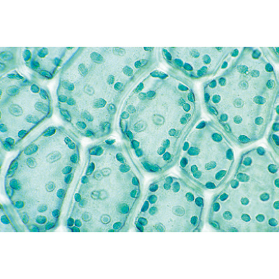 Briofitas (Hepáticos y Musgos), 1003972 [W13043], Micropreparados LIEDER