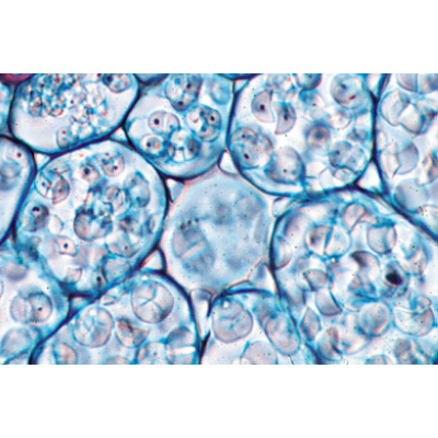 被子植物 III. 根部, 1003976 [W13047], 显微镜载玻片