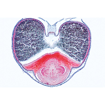 Angiospermes, fruits et graines - Anglais, 1003980 [W13051], Lames microscopiques Anglais