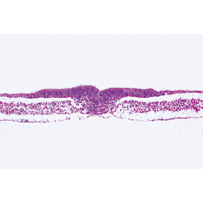 Chicken embryology (Gallus domesticus) - English Slides, 1003986 [W13057], Microscope Slides LIEDER