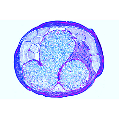 The Ascaris megalocephala Embryology - German, 1013478 [W13084], Microscope Slides LIEDER