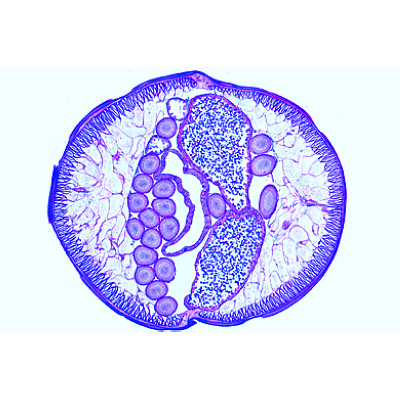 The Ascaris megalocephala Embryology - French, 1013480 [W13085], 현미경 슬라이드 LIEDER