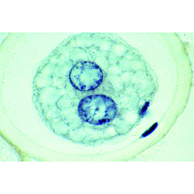 The Ascaris megalocephala Embryology - French, 1013480 [W13085], 细胞分裂