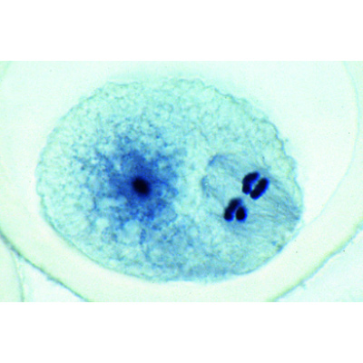 The Ascaris megalocephala Embryology - Spanish, 1013481 [W13086], 세포 분열