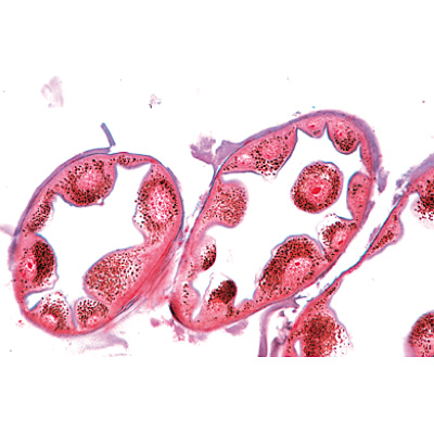 Series II. Metabolism - Spanish, 1004057 [W13301S], Microscope Slides LIEDER