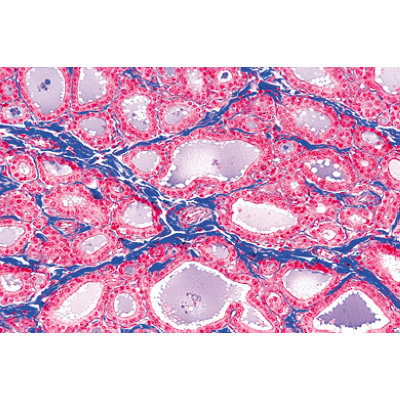 S&eacute;rie no. IV. Organes des hormones et fonctions hormonales - Allemand, 1004062 [W13303], Lames microscopiques Allemand