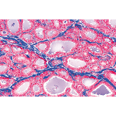 S&eacute;rie no. IV. Organes des hormones et fonctions hormonales - Fran&ccedil;ais, 1004063 [W13303F], Lames microscopiques Fran&ccedil;ais