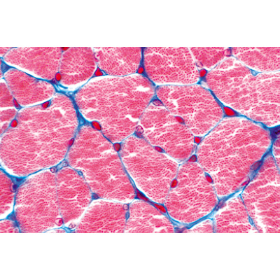 Normal Human Histology, Large Set, Part II. - French, 1004091 [W13310F], 프랑스어