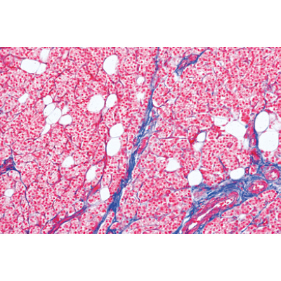 Histologie humaine, grande s&eacute;rie II partie - Espagnol, 1004093 [W13310S], Lames microscopiques Espagnol