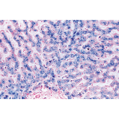 Human Pathology - German Slides, 1004094 [W13311], German