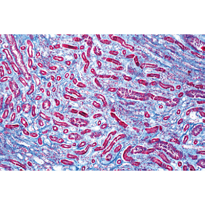 Pathologie humaine série de base - Allemand, 1004094 [W13311], Lames microscopiques Allemand
