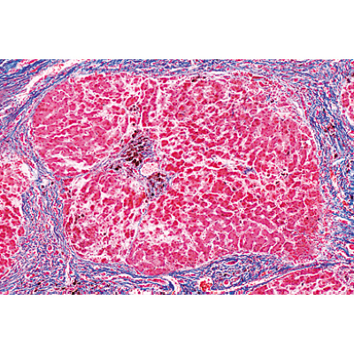 Pathologie humaine série de base - Allemand, 1004094 [W13311], Préparations microscopiques LIEDER