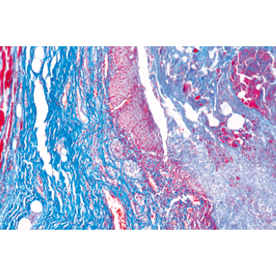 Pathologie humaine s&eacute;rie de base - Allemand, 1004094 [W13311], Lames microscopiques Allemand