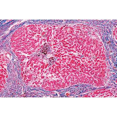 Human Pathology - Spanish, 1004097 [W13311S], Spanish