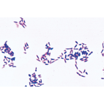 Pathogenic Bacteria - German Slides, 1004146 [W13324], 독일어
