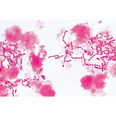 Pathogenic Bacteria - German Slides, 1004146 [W13324], 显微镜载玻片