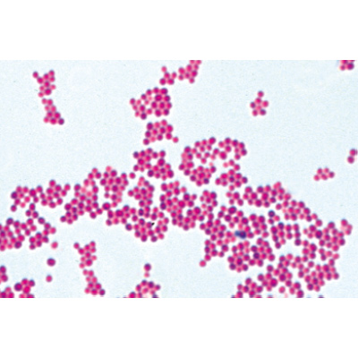 Bacterias Patógenas. İspanyolca (25'li), 1004149 [W13324S], Mikroskop Kaydırıcılar LIEDER