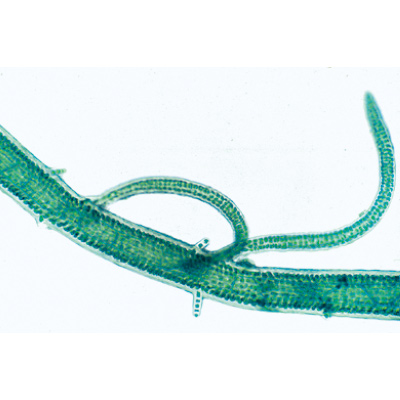Cryptogames, s&eacute;rie suppl&eacute;mentaire II - Portugais, 1004160 [W13327P], Lames microscopiques Portugais