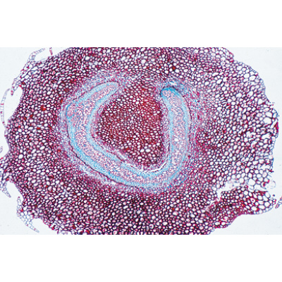 Disposition et types de paquets vasculaires - Portugais, 1004172 [W13330P], Lames microscopiques Portugais