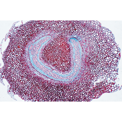 Disposition et types de paquets vasculaires - Espagnol, 1004173 [W13330S], Lames microscopiques Espagnol