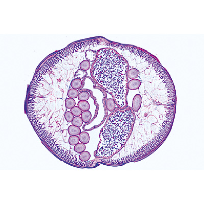 General Parasitology, Short Set - Spanish, 1004216 [W13341S], 显微镜载玻片