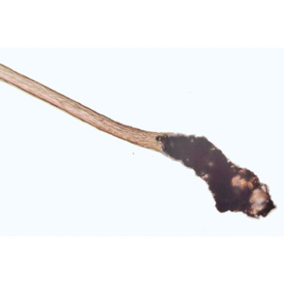 Structure fine du cuir chevelu, cheveux sains et malades - Allemand, 1004221 [W13343], Lames microscopiques Allemand