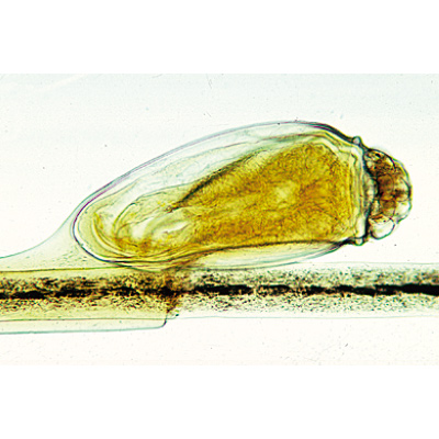 Human Scalp and Hair. Fransızca (12'li), 1004222 [W13343F], Mikroskop Kaydırıcılar LIEDER