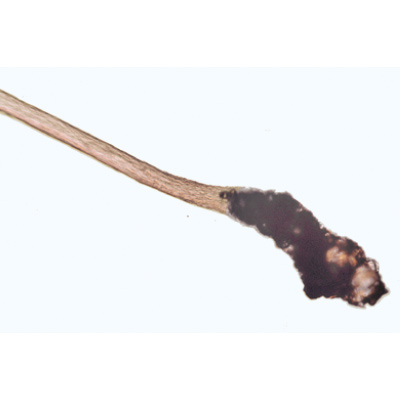 Human Scalp and Hair - Portuguese Slides, 1004223 [W13343P], Microscope Slides LIEDER