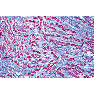 Human Pathology - English Slides, 1004236 [W13411], Microscope Slides LIEDER