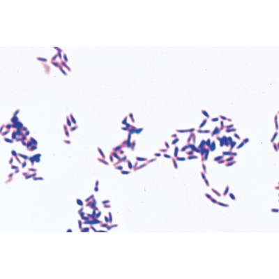 Bact&eacute;ries pathog&egrave;nes - Anglais, 1004249 [W13424], Lames microscopiques Anglais