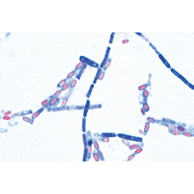 Bact&eacute;ries pathog&egrave;nes - Anglais, 1004249 [W13424], Lames microscopiques Anglais